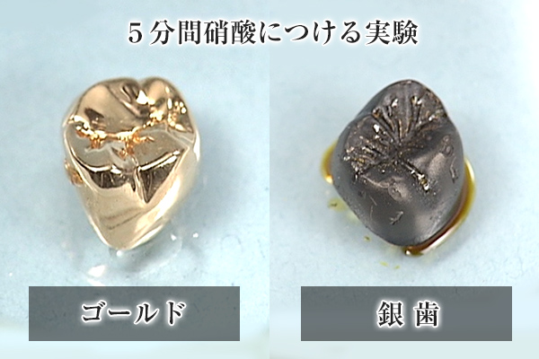 ゴールドと銀歯の硝酸実験結果を示す画像