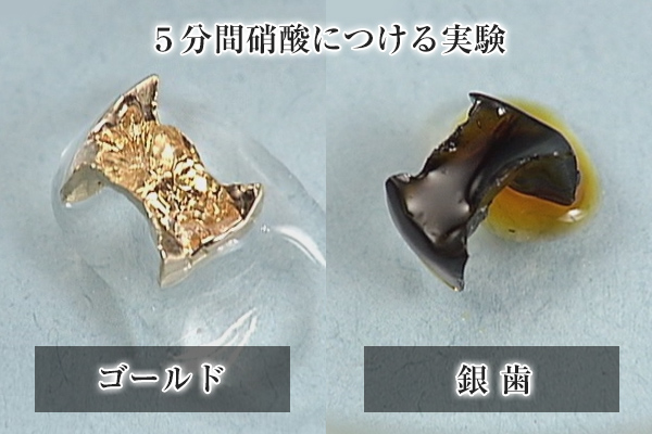 ゴールドと銀歯の硝酸実験結果の画像