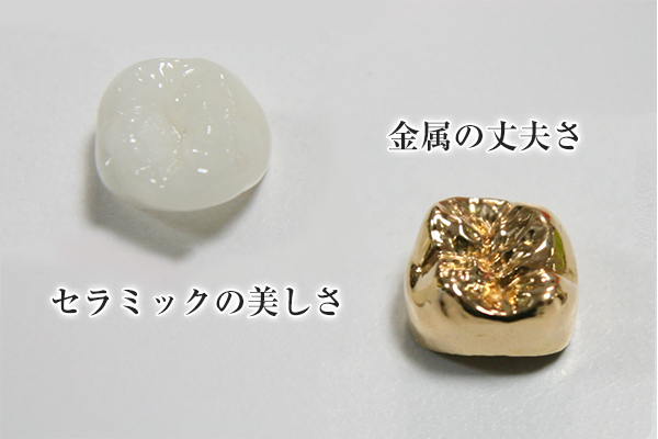 セラミックとゴールドの説明画像