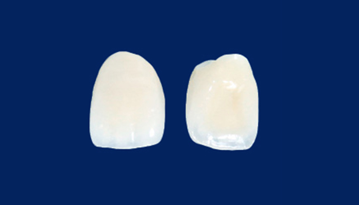 オールセラミック