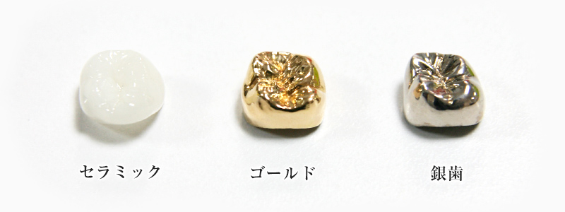 奥歯のかぶせものの比較画像