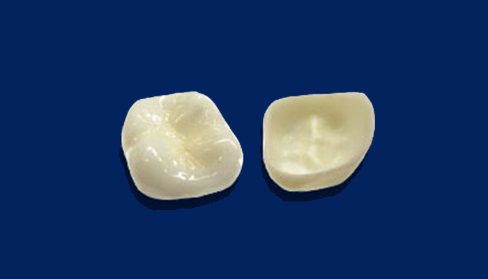 フルジルコニア