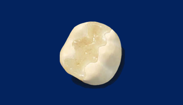 ハイブリッドセラミック