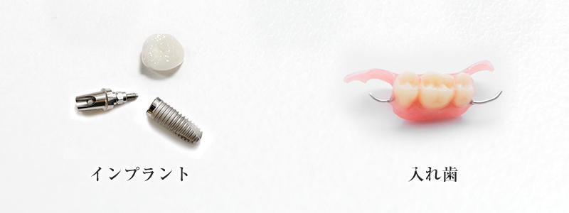 インプラントと入れ歯の違い