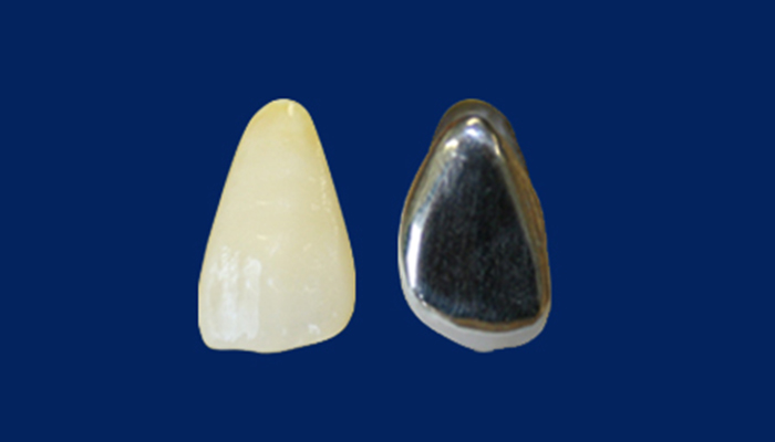 プラスティック前装冠